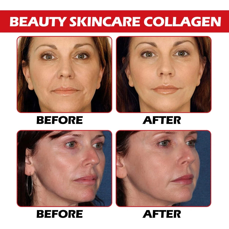 Filling Anti-wrinkle Suit Fading Wrinkle Moisturizing Anti-aging Skin Rejuvenation Firming Water BankCream