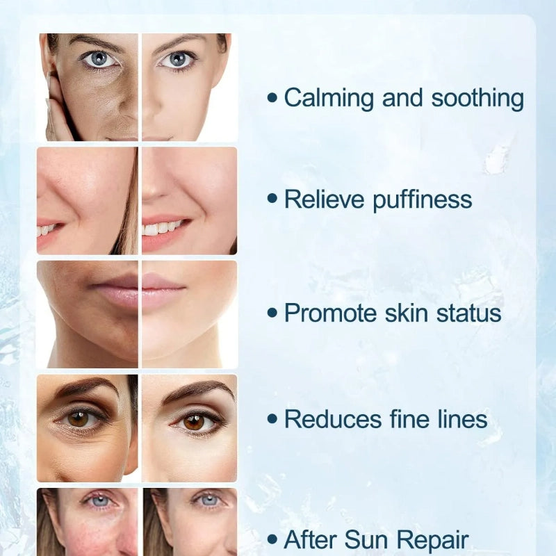 Cold Therapy Ice Cone Beauty Instrument – Home Skin Care Device for Pore Shrinking & Lifting