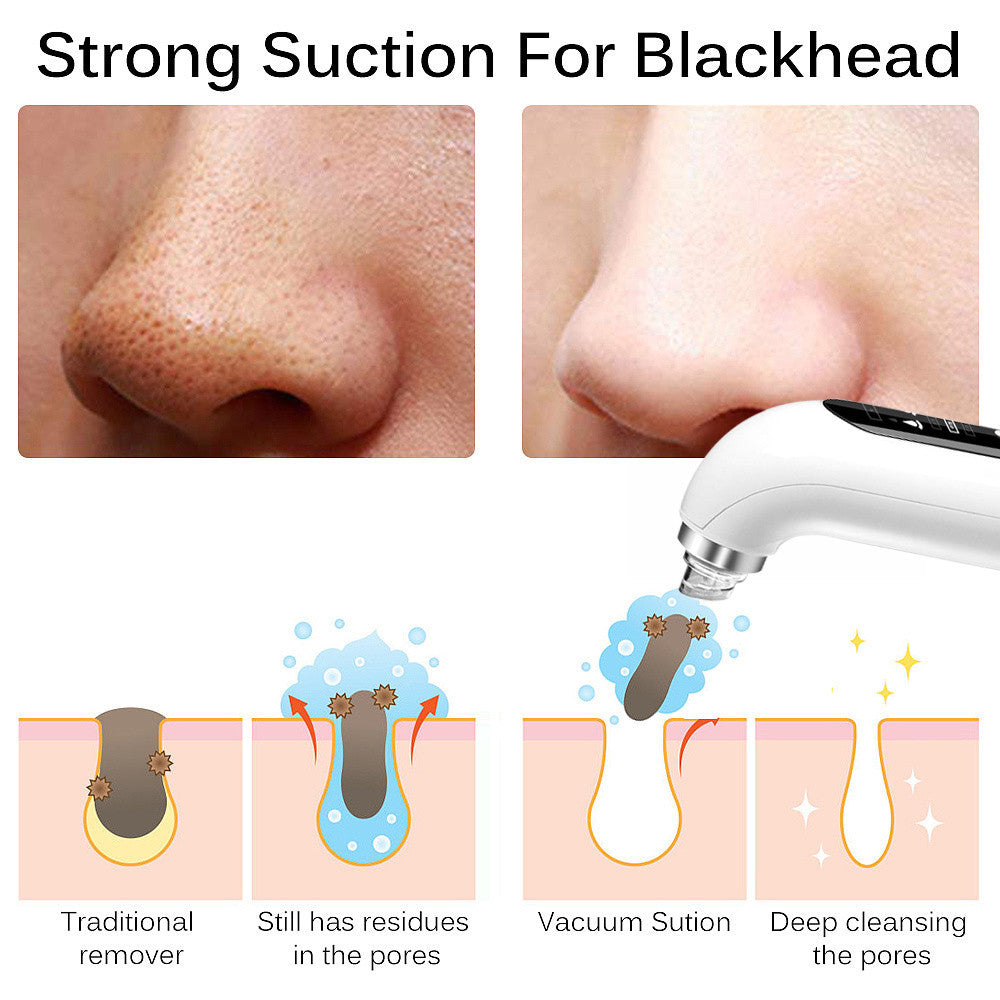Skin Cleansing Oxygenation Cleanser – Electric Blackhead Remover & Deep Facial Care Tool